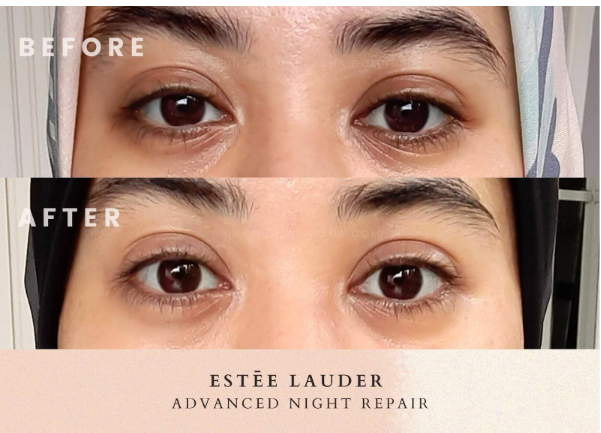 Best Eye Cream for Dark Circles and Puffiness Under Eyes: Top Picks That Actually Work